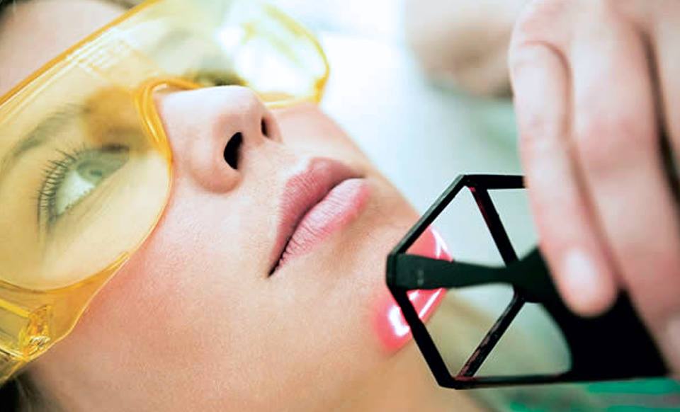 LASER FRAKCYJNY CO2